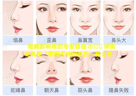 隆胸影响喂奶专家杨佳 🕊 琦揭秘真相「隆胸手感和真的一样么杨佳琦讲解」